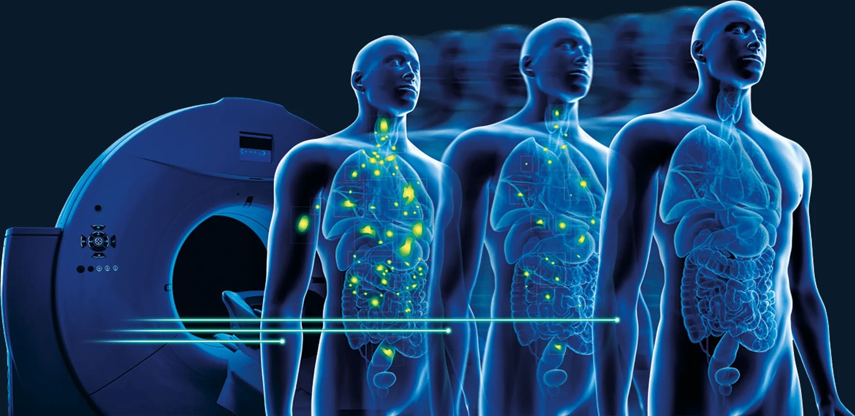 The ICPO Foundation key visual: a figure before a scanner, cancer markers receding across successive states.